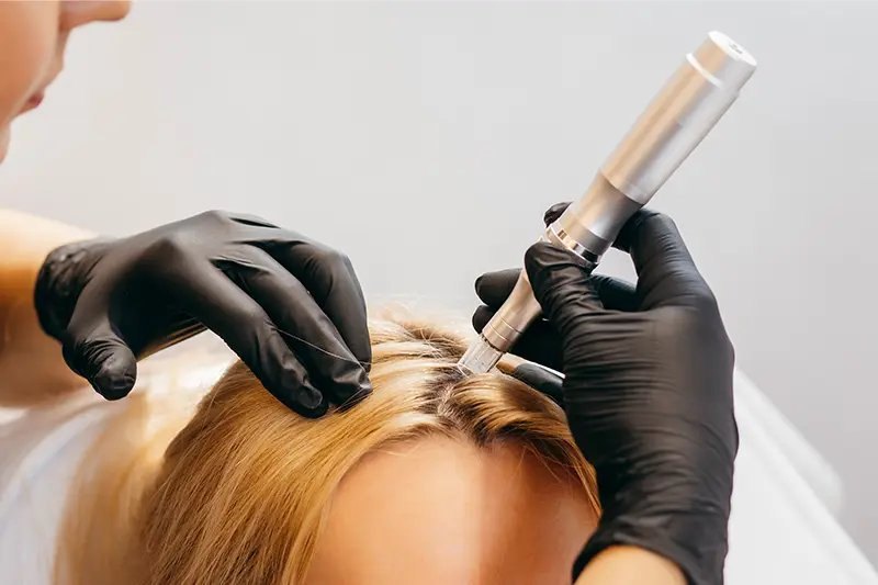Profissional de luvas examinando o couro cabeludo com um instrumento